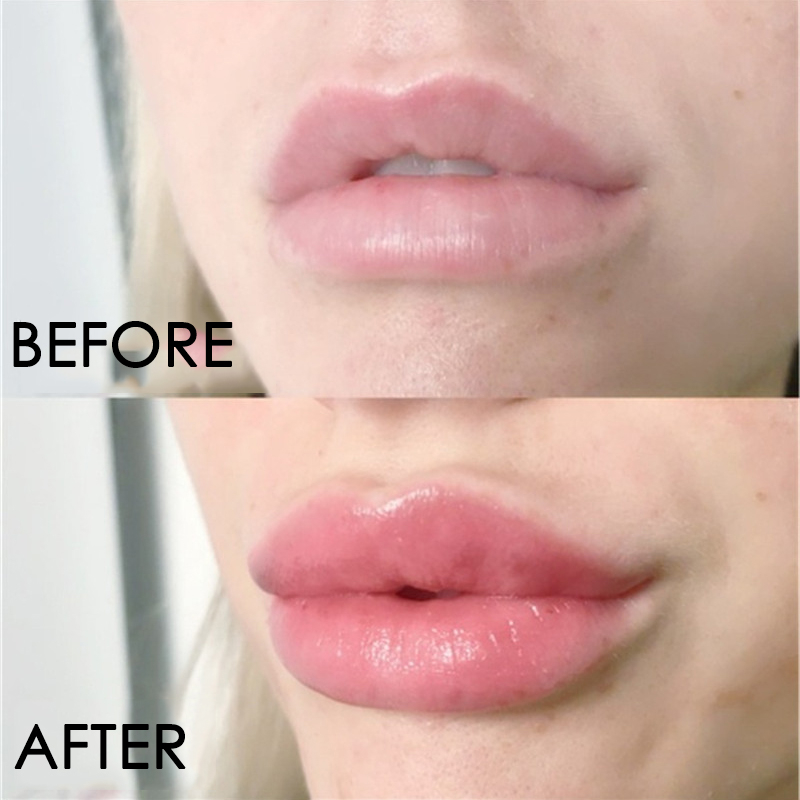 Сыворотка для ухода за губами, – обзор и цена Lip Gloss Plumping